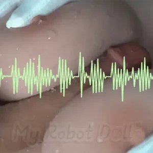 Remote-Controlled Automatic Breast Movement