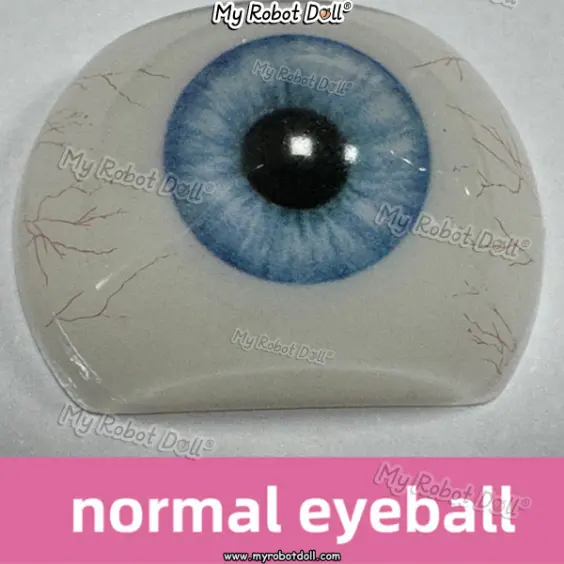 Normal Type