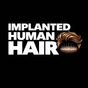 Implanted Human Hair