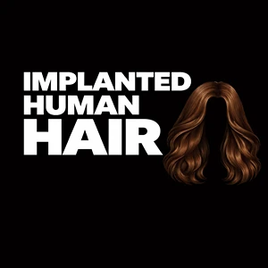 Implanted Human Hair