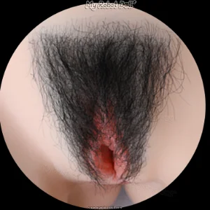 Implanted Pubic Haird